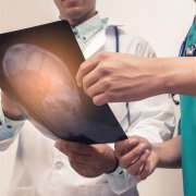 BNCT成为治疗脑癌的有效方法之一