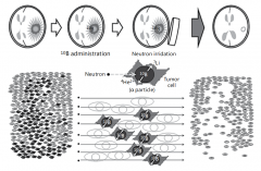 风头正劲的硼中子俘获（BNCT）真的足够成熟吗？